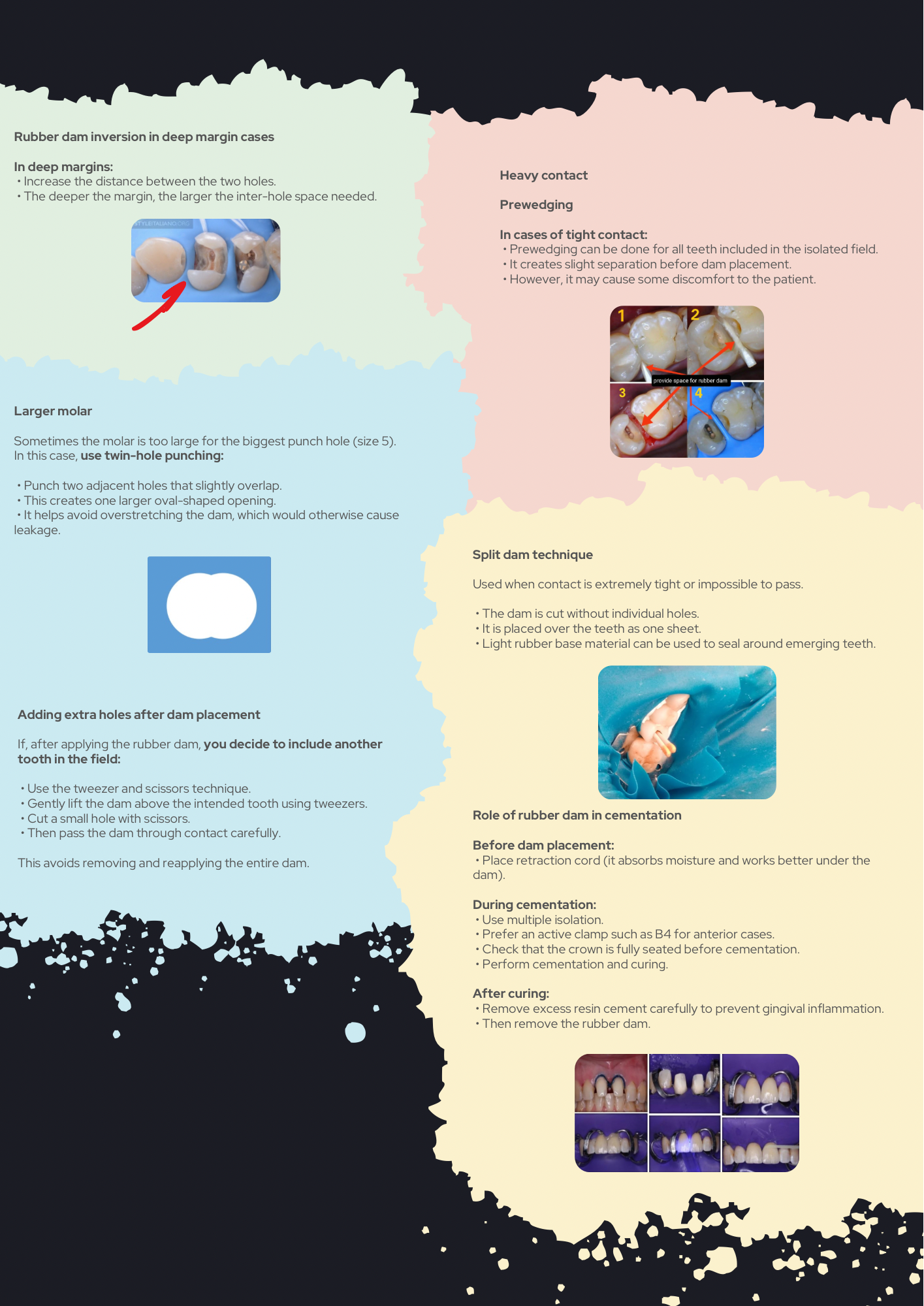 Rubber Dam Isolation Simplified: Every Technique Explained with Clinical Tips and Tricks — PDF Guidebook