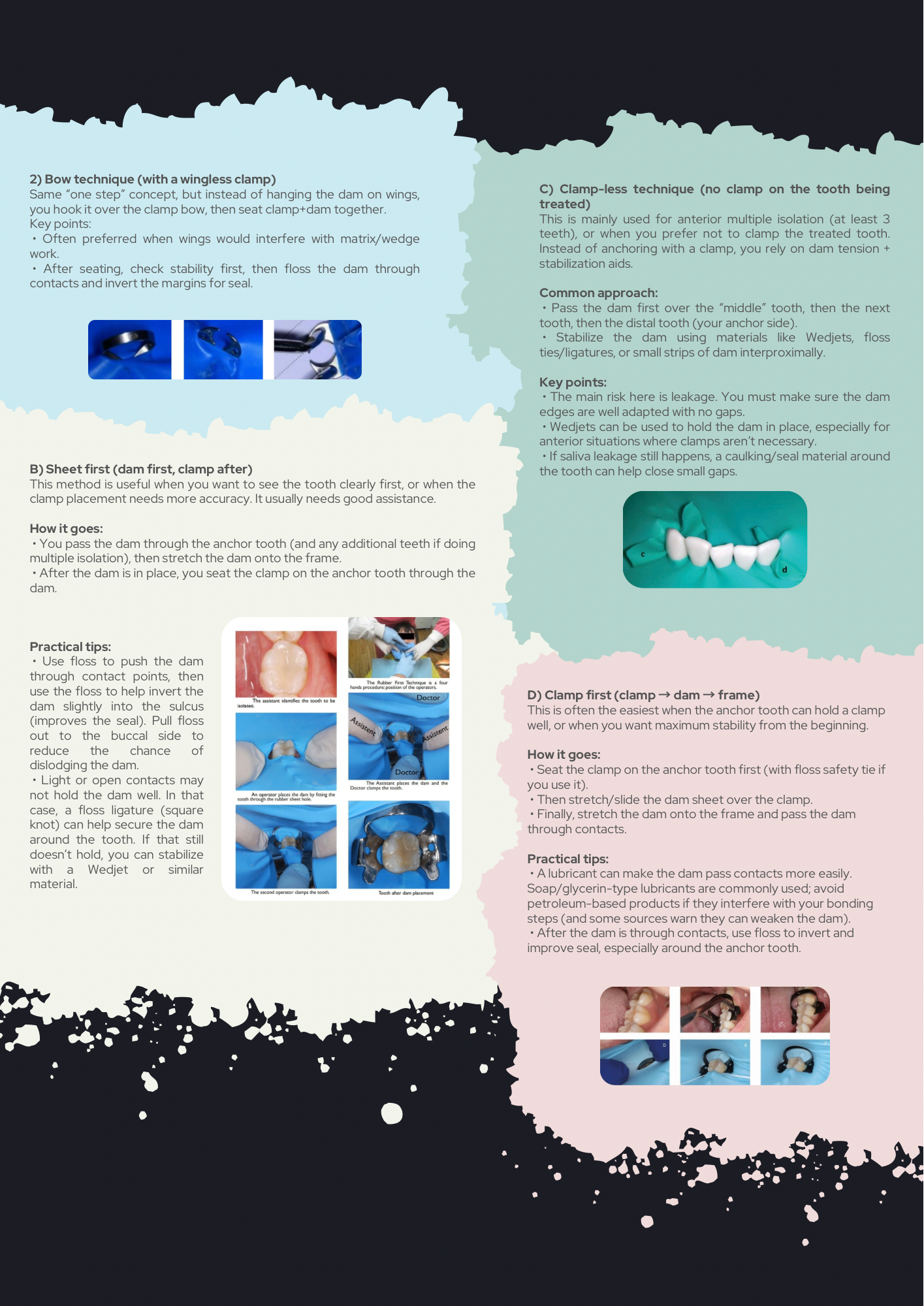 Rubber Dam Isolation Simplified: Every Technique Explained with Clinical Tips and Tricks — PDF Guidebook