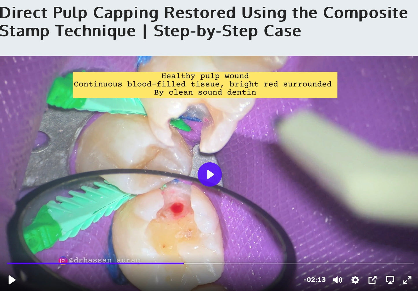 Dental PDF Guides, Video Lectures, MCQs,& Mock Tests!