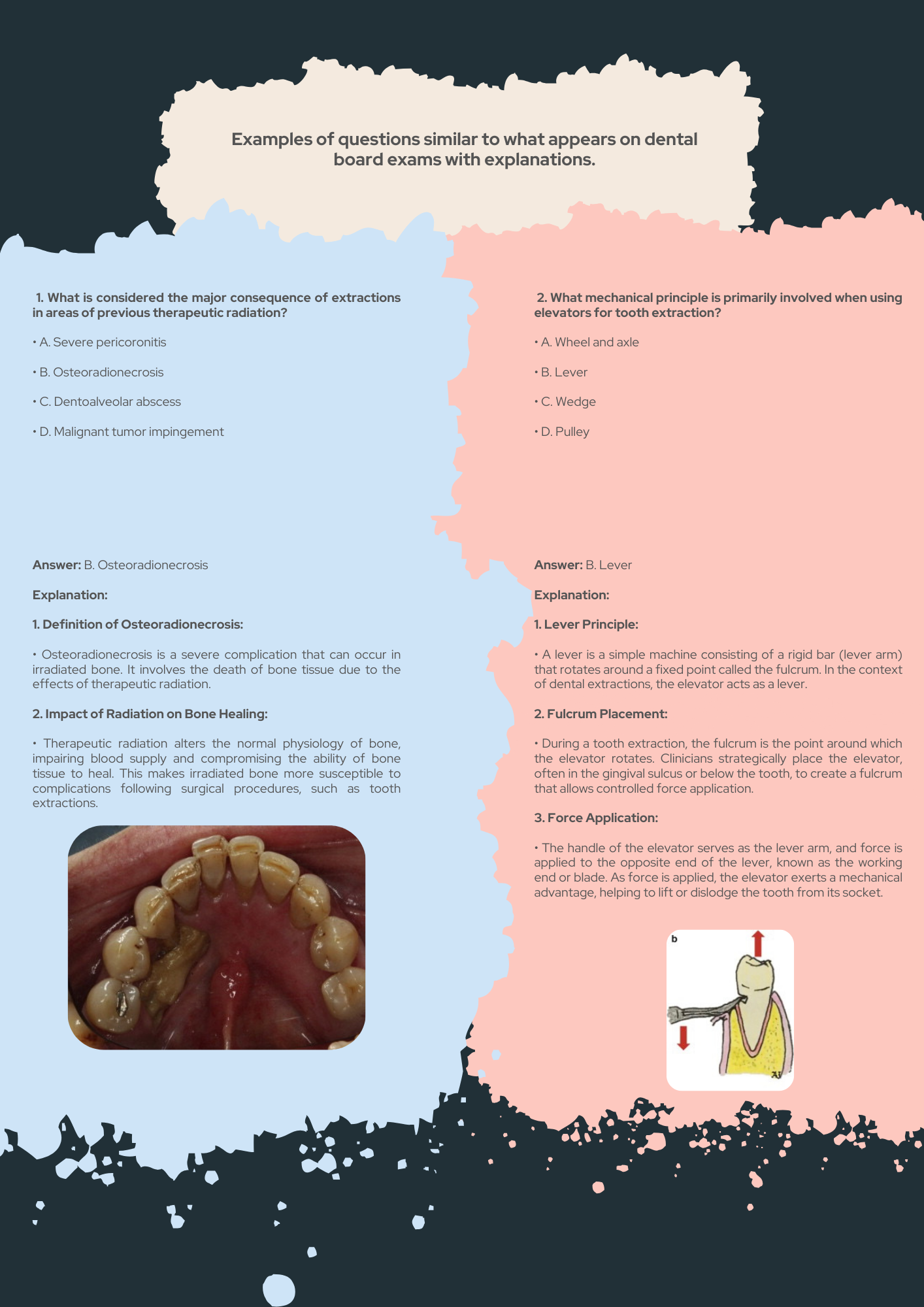 Oral Surgery Guide PDF With Oral Surgery Clinical Challenges with Explanations