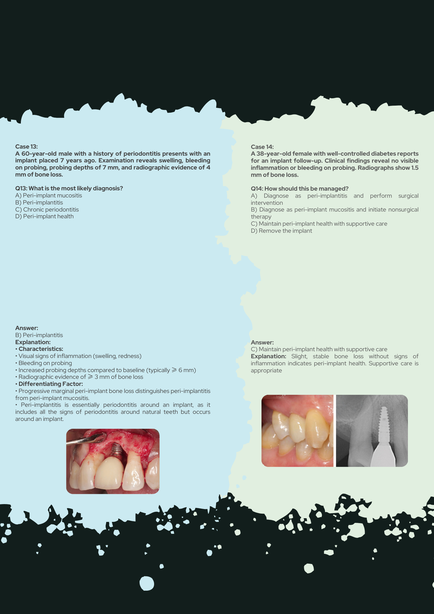 56 Periodontics Clinical Scenarios with 
Explanations