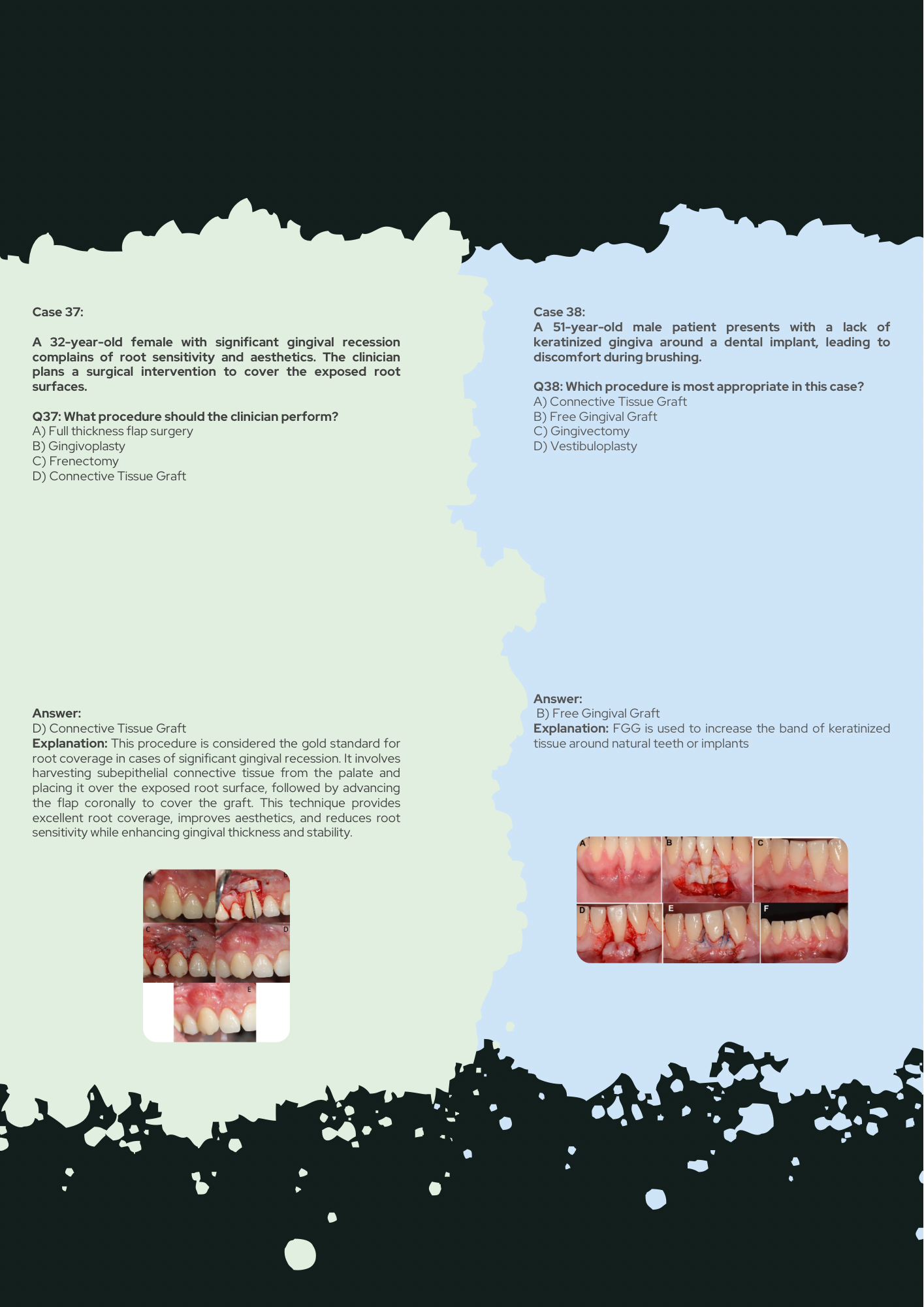 Dental PDF Guides, Video Lectures, MCQs,& Mock Tests!