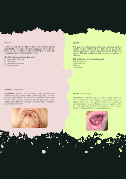 Oral Pathology Full Guide With 150 Clinical Case Questions Explained