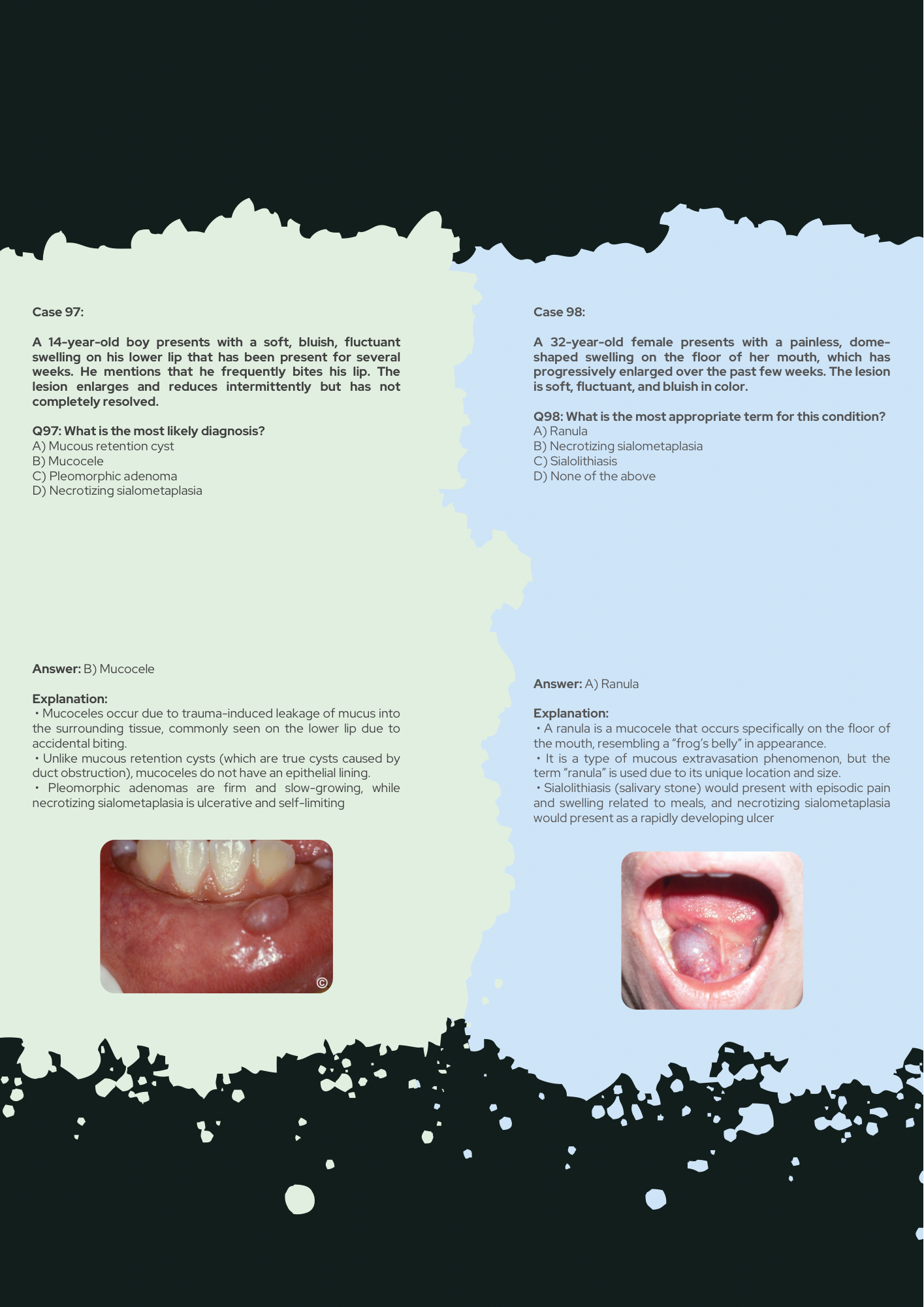 Oral Pathology Full Guide With 150 Clinical Case Questions Explained