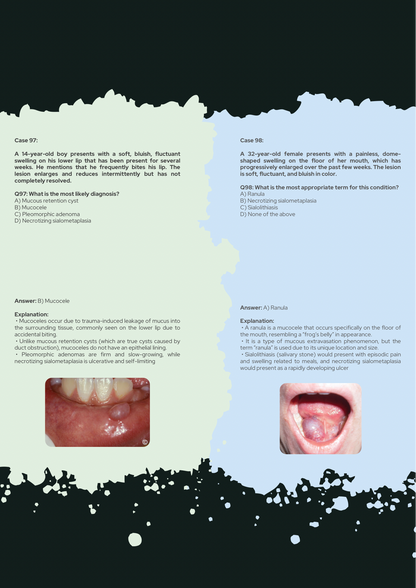 Oral Pathology Full Guide With 150 Clinical Case Questions Explained