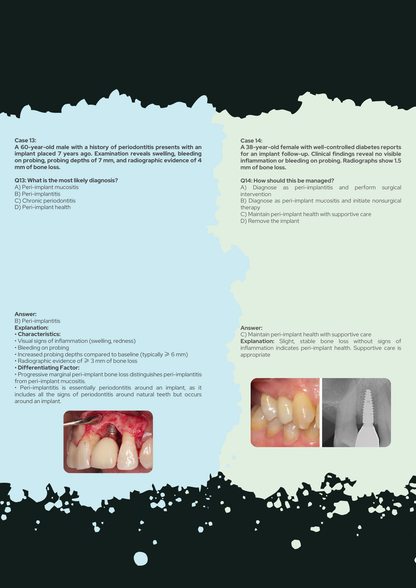Periodontics Full Guide PDF With Clinical Case Questions Explained