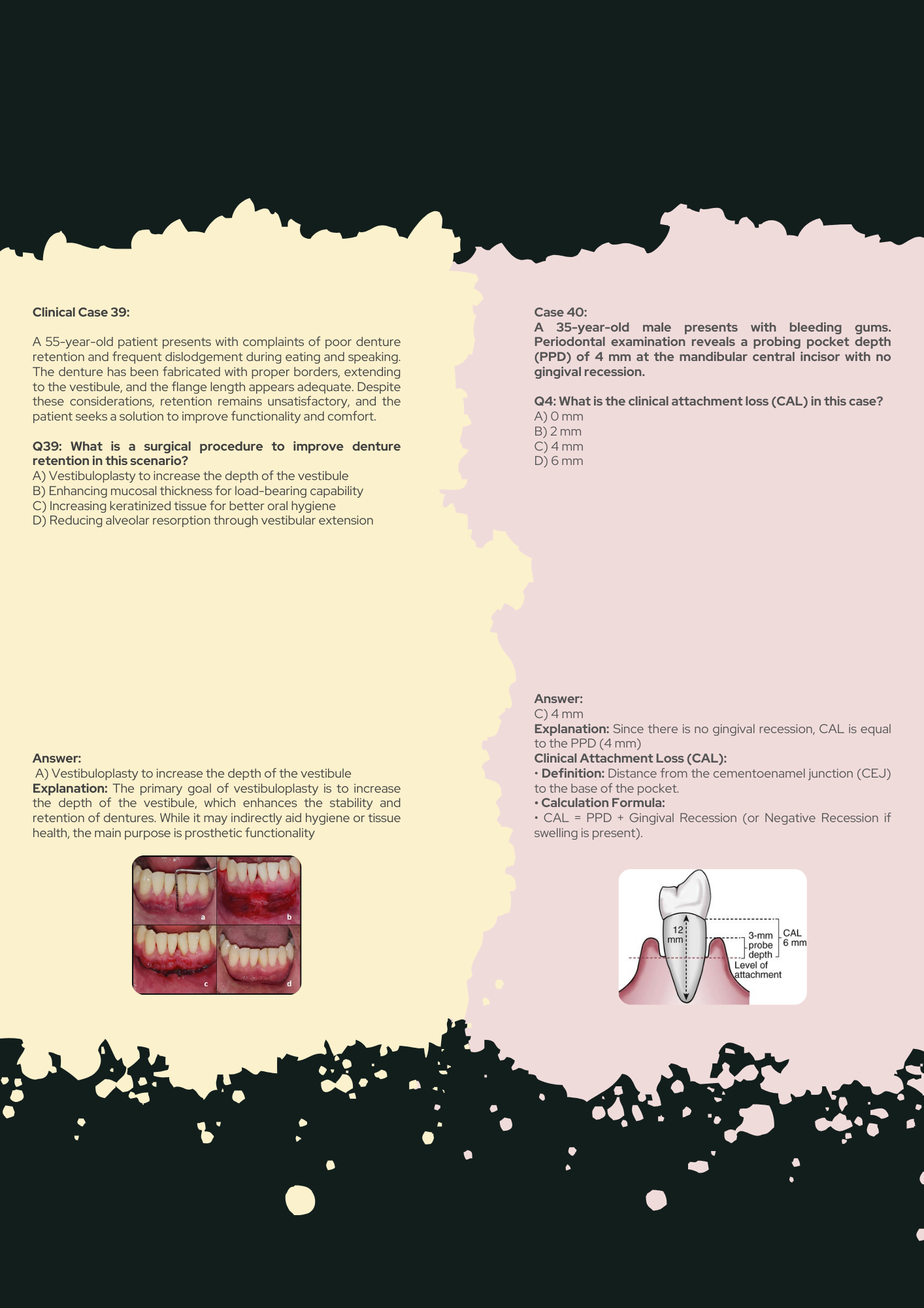 Periodontics Full Guide PDF With Clinical Case Questions Explained