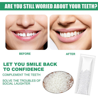 Resin Tooth Repair Glue Shapeable Teeth Gaps Filling